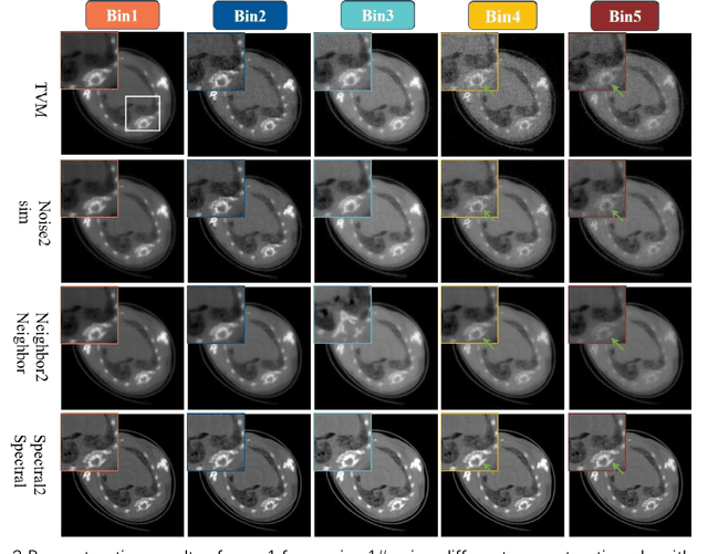 Figure 4 for Spectral2Spectral: Image-spectral Similarity Assisted Spectral CT Deep Reconstruction without Reference
