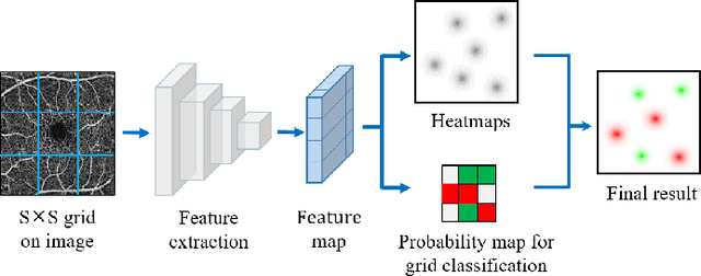 Figure 3 for Retinal Structure Detection in OCTA Image via Voting-based Multi-task Learning