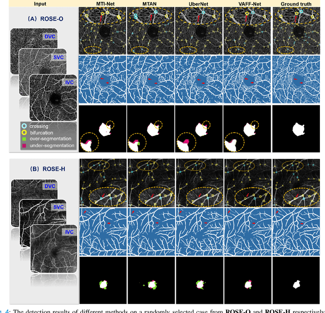 Figure 4 for Retinal Structure Detection in OCTA Image via Voting-based Multi-task Learning