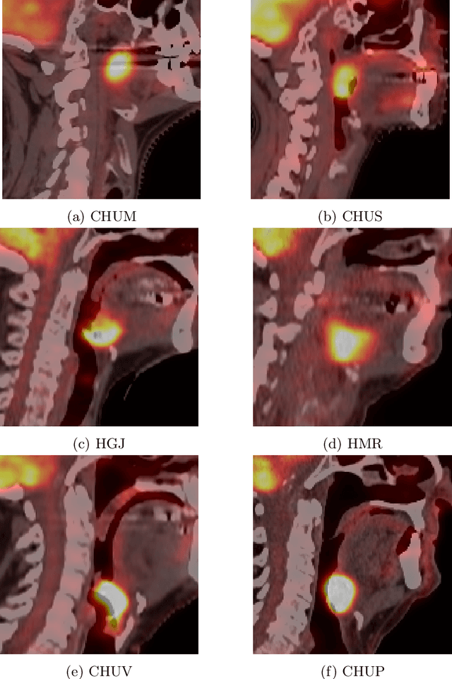 Figure 1 for Overview of the HECKTOR Challenge at MICCAI 2021: Automatic Head and Neck Tumor Segmentation and Outcome Prediction in PET/CT Images