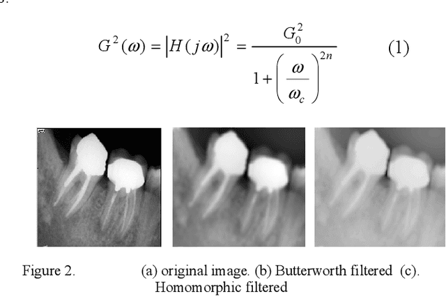 Figure 3 for Developing a Novel Approach for Periapical Dental Radiographs Segmentation