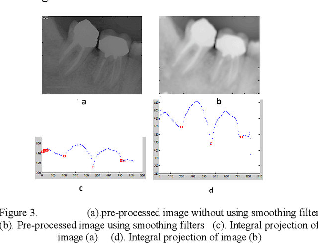Figure 4 for Developing a Novel Approach for Periapical Dental Radiographs Segmentation