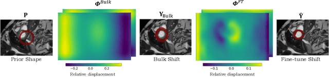 Figure 3 for TEDS-Net: Enforcing Diffeomorphisms in Spatial Transformers to Guarantee Topology Preservation in Segmentations