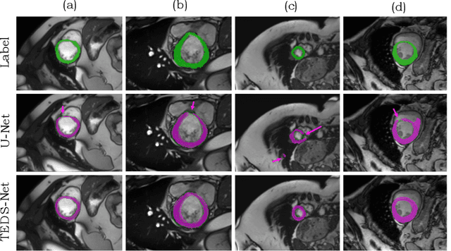 Figure 4 for TEDS-Net: Enforcing Diffeomorphisms in Spatial Transformers to Guarantee Topology Preservation in Segmentations