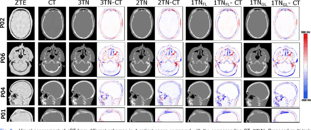 Figure 2 for Region of Interest focused MRI to Synthetic CT Translation using Regression and Classification Multi-task Network