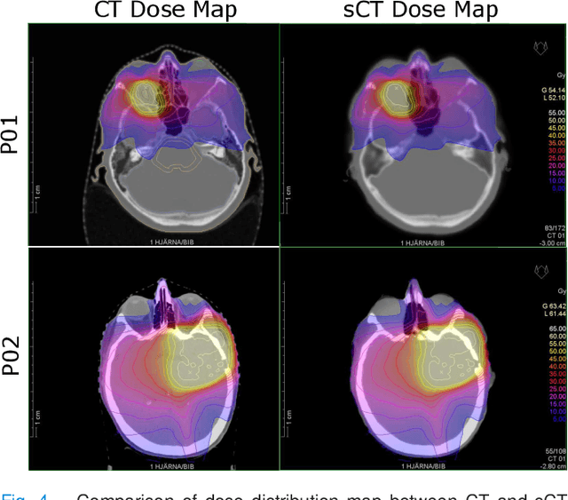 Figure 4 for Region of Interest focused MRI to Synthetic CT Translation using Regression and Classification Multi-task Network