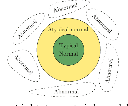 Figure 1 for One-Class Feature Learning Using Intra-Class Splitting