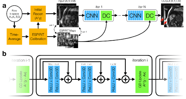 Figure 1 for Accelerating cardiac cine MRI beyond compressed sensing using DL-ESPIRiT
