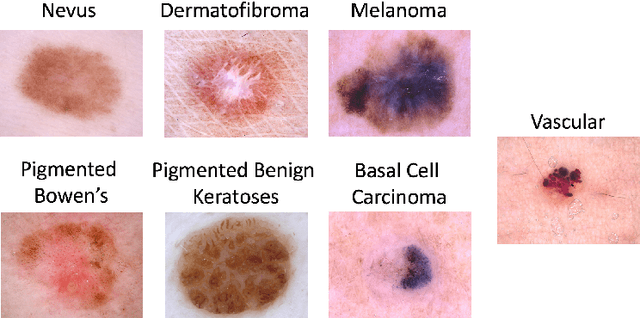 Figure 1 for Ensemble of Convolutional Neural Networks for Dermoscopic Images Classification