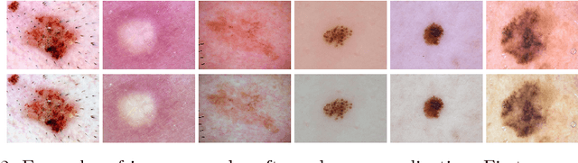 Figure 3 for Ensemble of Convolutional Neural Networks for Dermoscopic Images Classification