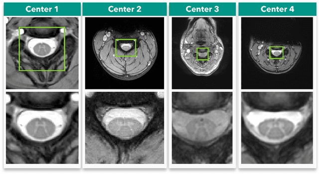 Figure 1 for Spinal cord gray matter segmentation using deep dilated convolutions