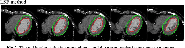 Figure 2 for Cardiac CT segmentation based on distance regularized level set