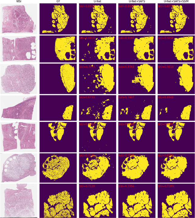 Figure 4 for Structure-aware scale-adaptive networks for cancer segmentation in whole-slide images
