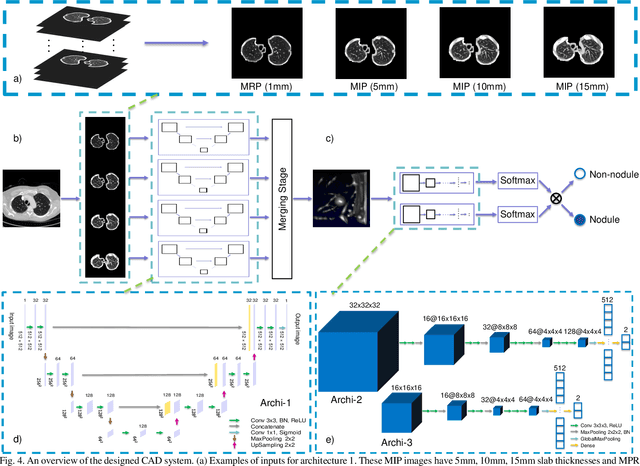 Figure 4 for Automatic Pulmonary Nodule Detection in CT Scans Using Convolutional Neural Networks Based on Maximum Intensity Projection