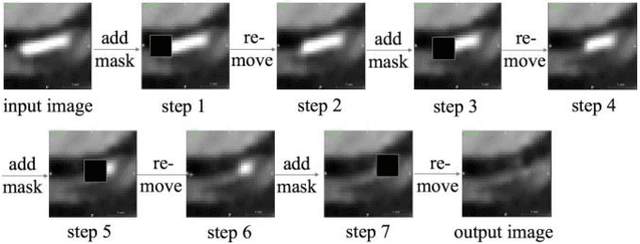 Figure 2 for Calcium Removal From Cardiac CT Images Using Deep Convolutional Neural Network