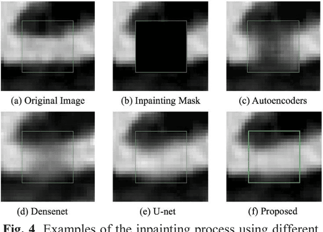 Figure 4 for Calcium Removal From Cardiac CT Images Using Deep Convolutional Neural Network