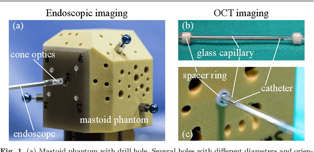 Figure 1 for Endoscopic vs. volumetric OCT imaging of mastoid bone structure for pose estimation in minimally invasive cochlear implant surgery