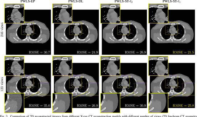 Figure 3 for Sparse-View X-Ray CT Reconstruction Using $\ell_1$ Prior with Learned Transform