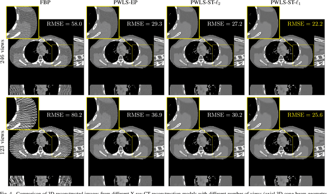 Figure 4 for Sparse-View X-Ray CT Reconstruction Using $\ell_1$ Prior with Learned Transform