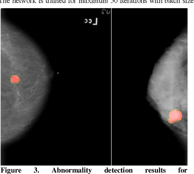 Figure 4 for Deep learning approach for breast cancer diagnosis