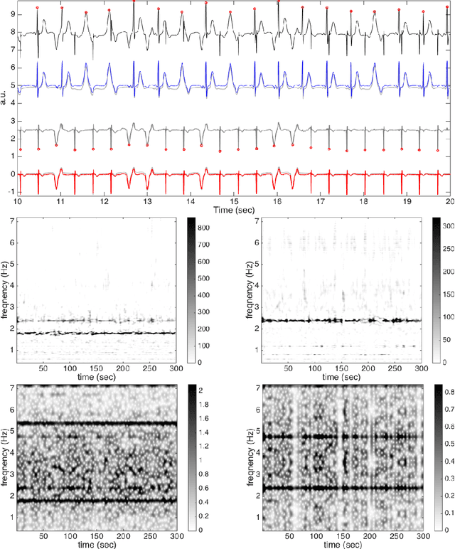 Figure 4 for Extract fetal ECG from single-lead abdominal ECG by de-shape short time Fourier transform and nonlocal median