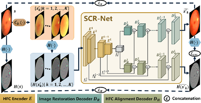 Figure 1 for Structure-consistent Restoration Network for Cataract Fundus Image Enhancement
