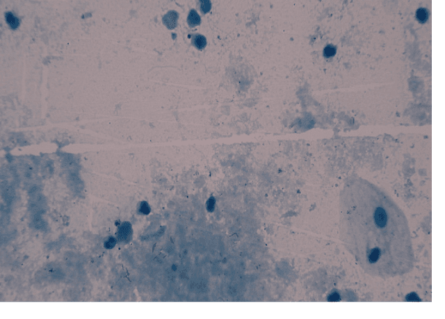Figure 3 for Design to automate the detection and counting of Tuberculosis bacilli