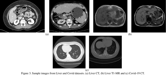 Figure 4 for Cross-Domain Segmentation with Adversarial Loss and Covariate Shift for Biomedical Imaging