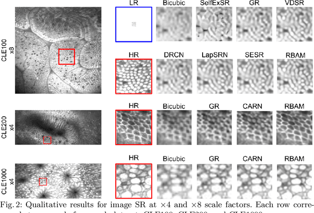 Figure 3 for Image Super Resolution via Bilinear Pooling: Application to Confocal Endomicroscopy