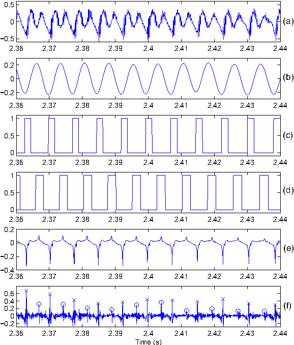 Figure 1 for Glottal Closure and Opening Instant Detection from Speech Signals