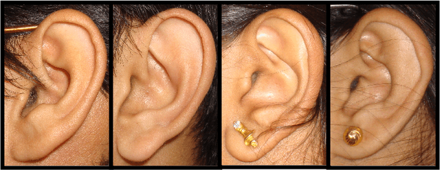 Figure 1 for Ear Identification by Fusion of Segmented Slice Regions using Invariant Features: An Experimental Manifold with Dual Fusion Approach