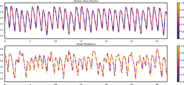 Figure 3 for DeepBeat: A multi-task deep learning approach to assess signal quality and arrhythmia detection in wearable devices