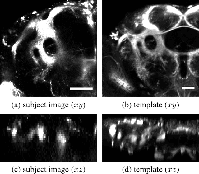 Figure 1 for Robust Registration of Calcium Images by Learned Contrast Synthesis