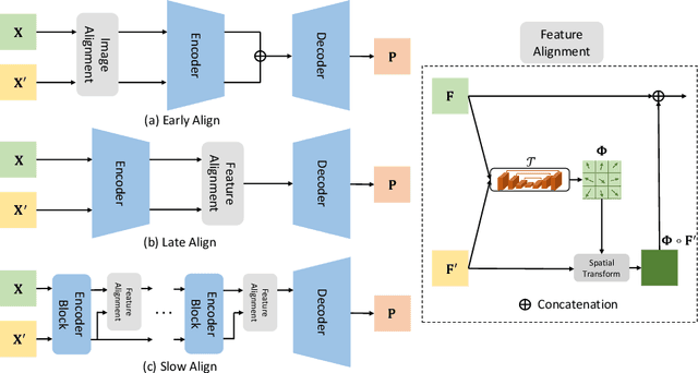 Figure 3 for Detecting Pancreatic Adenocarcinoma in Multi-phase CT Scans via Alignment Ensemble