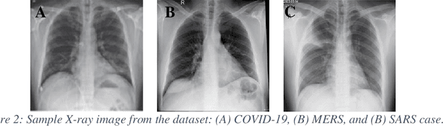 Figure 3 for Coronavirus: Comparing COVID-19, SARS and MERS in the eyes of AI