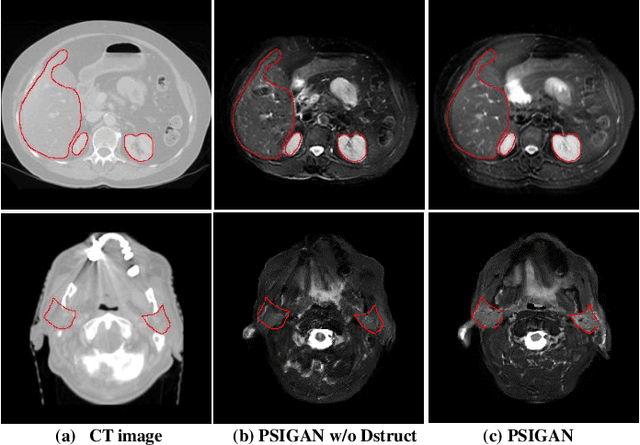 Figure 2 for PSIGAN: Joint probabilistic segmentation and image distribution matching for unpaired cross-modality adaptation based MRI segmentation