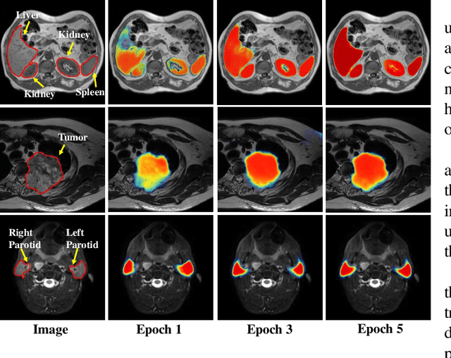 Figure 3 for PSIGAN: Joint probabilistic segmentation and image distribution matching for unpaired cross-modality adaptation based MRI segmentation