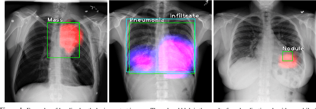 Figure 1 for Localization with Limited Annotation for Chest X-rays