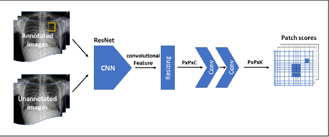 Figure 3 for Localization with Limited Annotation for Chest X-rays