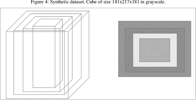 Figure 4 for Parallel 3DPIFCM Algorithm for Noisy Brain MRI Images