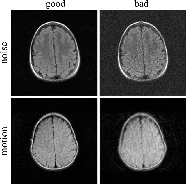 Figure 1 for Artifact- and content-specific quality assessment for MRI with image rulers