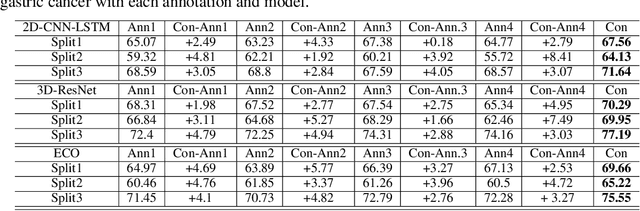 Figure 4 for Rethinking Generalization Performance of Surgical Phase Recognition with Expert-Generated Annotations