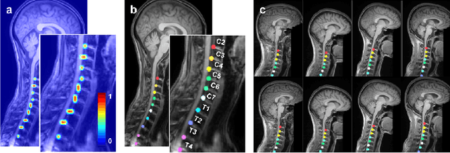 Figure 4 for Stacked Hourglass Network with a Multi-level Attention Mechanism: Where to Look for Intervertebral Disc Labeling