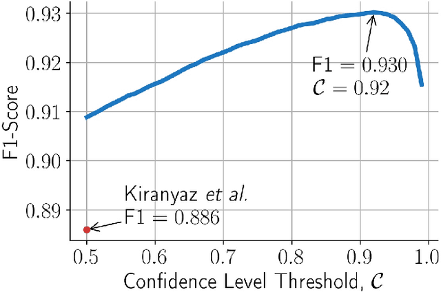 Figure 2 for A Personalized Zero-Shot ECG Arrhythmia Monitoring System: From Sparse Representation Based Domain Adaption to Energy Efficient Abnormal Beat Detection for Practical ECG Surveillance