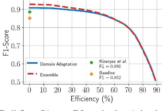 Figure 3 for A Personalized Zero-Shot ECG Arrhythmia Monitoring System: From Sparse Representation Based Domain Adaption to Energy Efficient Abnormal Beat Detection for Practical ECG Surveillance