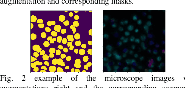 Figure 3 for Identify the cells' nuclei based on the deep learning neural network