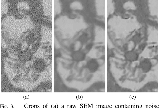 Figure 3 for Bayesian Deconvolution of Scanning Electron Microscopy Images Using Point-spread Function Estimation and Non-local Regularization