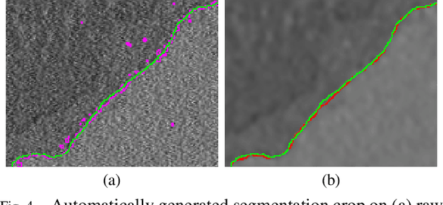 Figure 4 for Bayesian Deconvolution of Scanning Electron Microscopy Images Using Point-spread Function Estimation and Non-local Regularization
