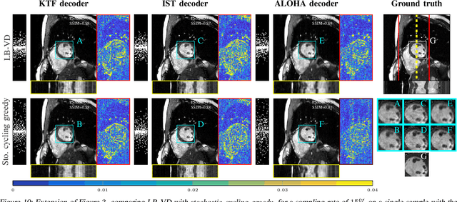 Figure 2 for Scalable Learning-Based Sampling Optimization for Compressive Dynamic MRI