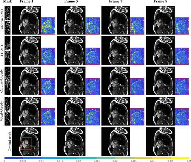 Figure 4 for Scalable Learning-Based Sampling Optimization for Compressive Dynamic MRI
